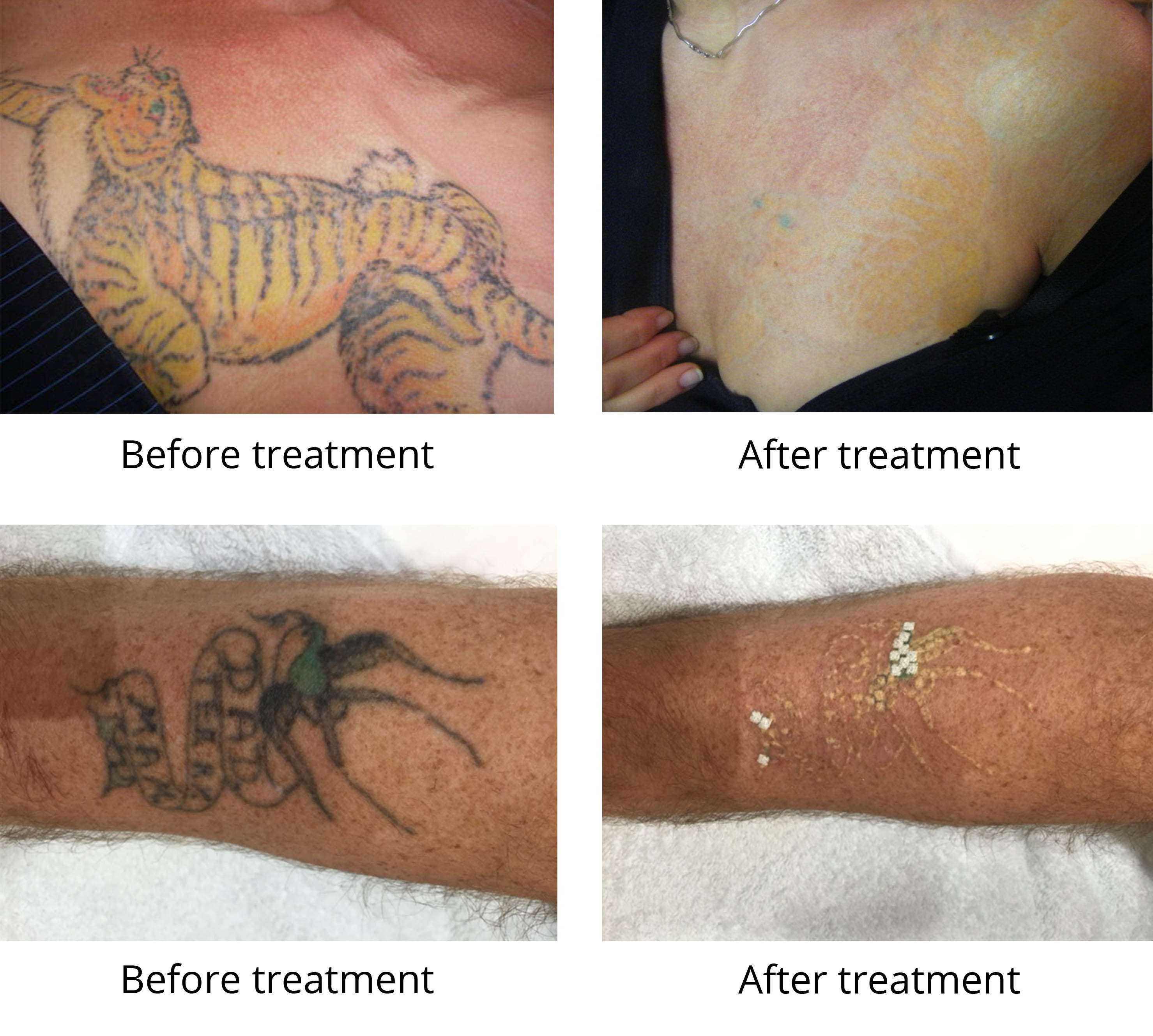 HandPost Aesthetic Clinic - Tattoo Removal & Pigmentation